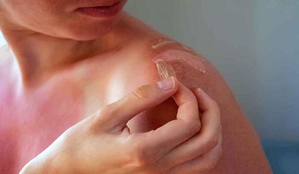 Woman peeling her skin